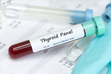Thyroid Disorders